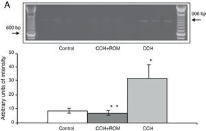Levels of NR2A mRNA in the prefrontal cortex of the rat. (A) Gel photograph representing the different study groups. Mean±SD of 4 duplicate experiments. *P<.05 CCI4 vs C. **P<.05 CCI4+ROM vs CCI4.