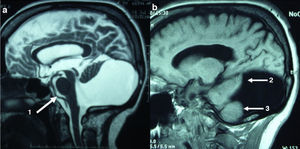 MR images in a sagittal slice (see description in text).