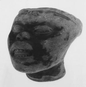 Artistic representation of an individual with Down's syndrome characteristics. Tolita–Tumaco culture (300 BCE–600 CE). Gold Museum, Bogotá, Colombia.