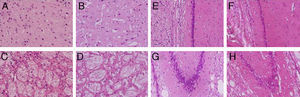 H&E stains of coronal slices of the cortex (A and B), the striatum (C and D), CA1 (E and F), and CA3 (G and H) at 40× magnification. Columns on the left show slices taken from control-group animals; columns on the right show sections from animals with cerebral hypoperfusion at 7 days post-lesion.