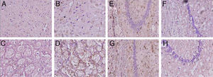 Microphotographs showing coronal slices from rat brains with glial fibrillary acid protein immunostaining in the cortex (A and B) the striatum (C and D), CA1 (E and F), and CA3 (G and H) at 40× magnification. Columns on the left show slices taken from control-group animals; columns on the right show sections from animals with cerebral hypoperfusion at 7 days post-lesion.