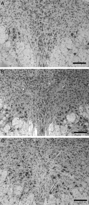 Histological images representing coronal slices of the dorsal raphe nucleus. Note the normal histological appearance in the control group (A), histopathological characteristics after microinjection of the vehicle in the sham-operated group (B), and after administration of the 5,7-dihydroxytryptamine neurotoxin used to destroy serotinergic neurons in the experimental group (C). Near total lack of neurons and a larger glial population in the experimental group compared to the sham-operated and control groups. f: medial longitudinal fasciculus; cresyl violet stain; bar=100μm.