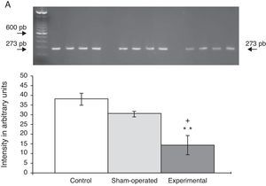 Levels of α7 mRNA in the dorsomedial PFC of rats with a lesioned dorsal raphe nucleus. (A) Image from gel electrophoresis study of the different groups. Data are expressed as mean±SD of 4 identical experiments. P<.05: **C vs E.