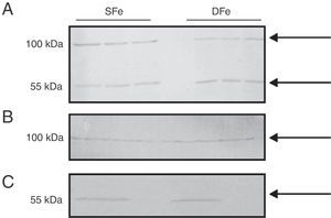 Western blot analysis of IGF-I expression in CNS cell cultures from BALB/c mice. (A) Mixed glial cell cultures, (B) Microglial cell cultures, (C) Neuron cell cultures. Cultures in iron-sufficient (SFe) or iron-deficient (DFe) conditions. Arrows indicate the bands detected by the antibody.