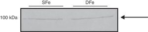 Western blot analysis of IGF-IR expression in CNS cell cultures from newborn BALB/c mice. Cultures in iron-sufficient (SFe) or iron-deficient (DFe) conditions. The arrow indicates IGF-IRβ.