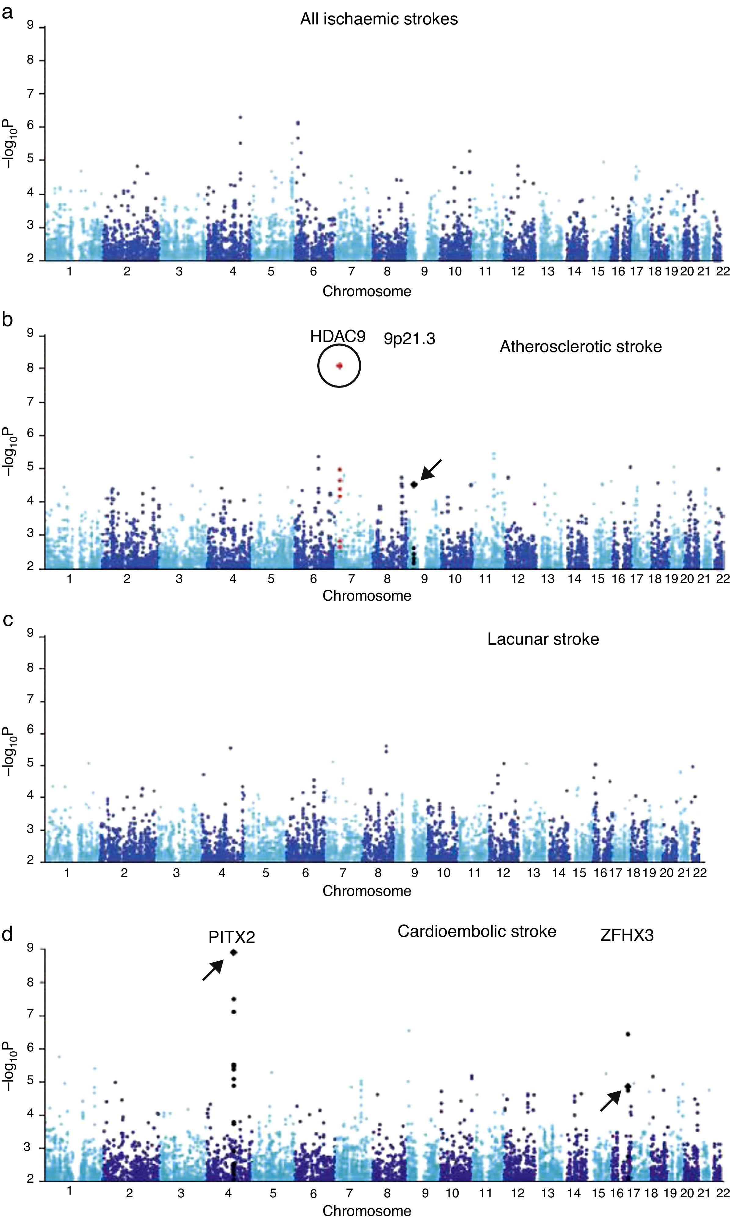 Exploring the genetic basis of stroke. Spanish stroke genetics ...