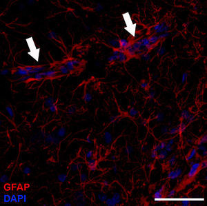 Astrocytes are distinguished by their starlike shape; cerebral capillaries are nearly completely surrounded by astrocytic endfeet (arrows). Immunohistochemical stain for GFAP (red: astrocytes; blue: nuclei). Confocal microscopy image. Bar=70μm.
