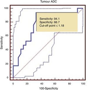 ROC curve for estimating the ADC cut-off point by tumour grade.