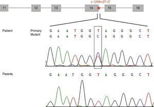 Diagram of the genomic structure of the fragment (exons 11 to 16) of STXBP1 containing the mutation c.1249+2T>C (located at intron 14 and marked with an asterisk). The electropherogram shows the mutation c.1249+2T>C identified in our patient and the corresponding sequence in each of his parents, which suggests that it is a de novo mutation.