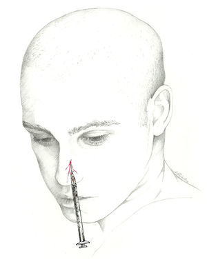 Approach to the external nasal nerve.