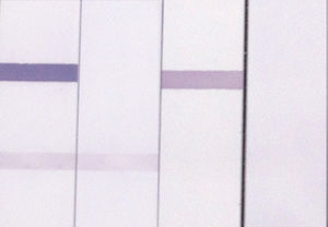 Immunoblot strip showing reactivity of different sera with anti-Ma (column 1), anti-Ma1 (column 2), or anti-Ma2 (column 3), or negative control (column 4).