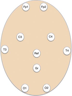 Diagram showing the placement of the self-adhesive electrodes for the basic system of 8 EEG channels used for emergency EEG recordings. C: parietal; Fp: frontopolar; Gnd: ground; O: occipital; Ref: reference; T: temporal.