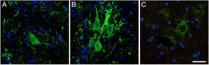 Immunofluorescence images showing peripherin (PERI) expression in the cALS-CSF group over the course of the study (A: 20 days; B: 45 days; C: 82 days). A temporary increase in peripherin expression was observed in motor neurons at day 45; this returned to baseline conditions at day 82. Increased peripherin expression has been associated with spinal cord lesions; under normal circumstances, the protein is expressed at lower levels. Scale bar: 40 μm.