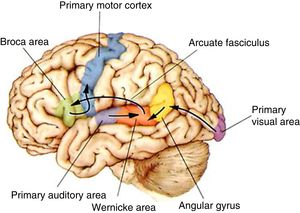 The functional pathways involved in comprehension, repetition, and production of written, gesture, and spoken language, according to the Wernicke-Geschwind model. Within the left hemisphere, language organisation follows certain anatomical pathways for language comprehension, repetition, and production. Sounds are processed by the bilateral auditory cortex, in the superior temporal gyrus (primary auditory area), and decoded in the posterior area of the left temporal cortex (Wernicke area); the latter is connected to other cortical areas or networks which assign meaning to words. During reading, output from the primary visual area (bilaterally) travels to other parieto-occipital association areas for word and phrase recognition (especially the left fusiform gyrus, located in the inferior surface of the temporal lobe, where there is a key word recognition centre) and reaches the angular gyrus, which processes language-related visual and auditory information. In spontaneous language repetition and production, auditory information must travel through the arcuate fasciculus towards the left inferior frontal region (Broca area), which is responsible for language production; this area is also known to be involved in such other functions as action comprehension (mirror neurons). To produce written or spoken language, output from the Wernicke area, the Broca area, and nearby association areas must reach the primary motor cortex.10,11 Adapted with permission from Bear et al.10