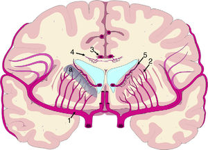Vascularisation of periventricular structures. The basal ganglia and internal capsule are located in a last meadow area (a) between the territory of the perforating branches (2) of the middle cerebral artery (1) and the branches of the subependymal arteries (5). The corpus callosum is irrigated mainly by the short callosal arteries (4) from the pericallosal artery (3), which belong to the terminal circulation.