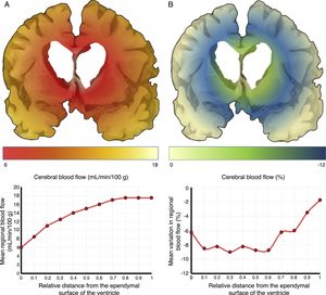 Cerebral blood flow (CBF) in the periventricular region in patients with idiopathic normal-pressure hydrocephalus. (A) The relationship between CBF and distance to the ependymal surface of the ventricle follows a logarithmic curve.18 (B) When patients experience fluid overload, CBF drops in the subependymal last meadow area, located 5-15mm from the ventricular surface.
