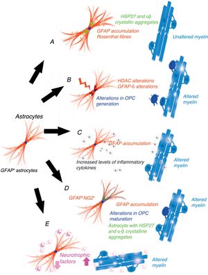 Schematic representation of the hypotheses explaining myelin changes in AxD. (A) Gain-of-function mechanism. (B) Epigenetic alterations on transcription. (C) The inflammatory mechanism. (D) GFAP+/NG2+ cells. (E) Post-transcriptional alterations of GFAP.
