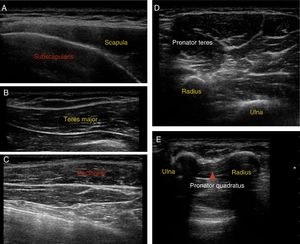 Ultrasound images of muscle localisation.