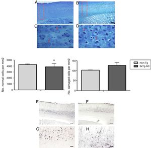Representative photomicrographs from the primary motor cortex. A and C) Sagittal sections stained using the Klüver-Barrera technique; the arrows indicate cells with normal morphological characteristics (non-Tg). B and D) Representative tissue sample from the 3xTg-AD model; the arrows indicate cells with signs of damage. The graphs show mean±standard error of the mean (6 individuals per group) for the numbers of normal and abnormal cells. The asterisk indicates a statistically significant difference. E and G) Motor cortex (M1 region) from a 3xTg-AD mouse; Aβ expression is labelled with antibody Bam10. F and H) Labelling of tau protein. Calibration bars: 100μm (A, B, E, and F) and 10μm (C, D, G, and H).