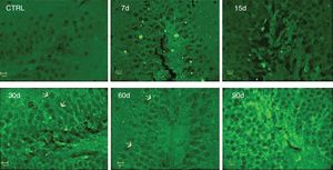 Effect of the exposure to low doses of ozone on hippocampal immunoreactivity to IL-17A. Animals were exposed for 7, 15, 30, 60, and 90 days. Images show the dentate gyrus magnified at 40×. Note that immunoreactivity to IL-17A increases considerably after 30, 60, and 90 days of exposure. Arrows indicate immunoreactivity to IL-17A.