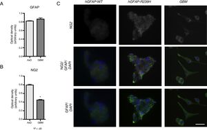 GFAP and NG2 expression. (A and B) GFAP and NG2 expression at 7 days of differentiation. (C) Immunofluorescence images of WT, transfected, and GBM cells showing different patterns of protein expression and types of cell groups. AxD neurospheres show greater GFAP+ filament aggregation and atypical NG2 expression in the cell membrane. In GBM cells, NG2 expression is observed in the cell membrane and in small perinuclear areas, whereas GFAP is expressed in the cytoskeleton and in the apical part of filopodia, where expression is more intense. Scale bar: 25μm. Graphs show means and standard error. *P<.05. GBM: glioblastoma multiforme.