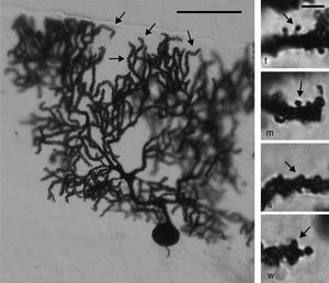 Left panel: photomicrograph of a Purkinje cell from the cortex of the cerebellar paramedian lobule. Arrows point to the distal dendritic branchlets where spines were counted. Scale bar: 100μm. Right panel: photomicrograph representing thin (t), mushroom (m), stubby (s), and wide (w) spines (arrows), similar to the ones counted in our study. Scale bar: 2μm.