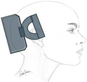 External application of a single-pulse transcranial magnetic stimulation device.