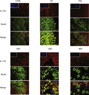 Effect of chronic exposure to low doses of ozone on IL-17A expression in neurons. Double-labelled fluorescence analysis of the hippocampus from rats exposed to low doses of ozone for 7, 15, 30, 60, and 90 days. Neurons are labelled in green and IL-17A in red. The main images show the dentate gyrus at 100× magnification; boxes show the same structure at 10× magnification. Blue arrows indicate marker colocalisation. Note that neurons in the dentate gyrus present higher immunoreactivity to IL-17A at 60 and 90 days of exposure. Scale bar=20microns.