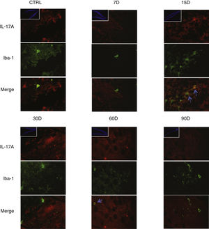 Effect of chronic exposure to low doses of ozone on IL-17A expression in astrocytes. Double-labelled fluorescence analysis of the hippocampus from rats exposed to low doses of ozone for 7, 15, 30, 30, 60, and 90 days. Astrocytes are labelled in green and IL-17A in red. The main images show the dentate gyrus at 100× magnification; boxes show the same structure at 10× magnification. Blue arrows indicate marker colocalisation. Note that astrocytes in the dentate gyrus present higher immunoreactivity to IL-17A at 90 days of exposure. Note also the increase in the number of astrocytes and the length of their projections from 15 to 90 days of exposure. Scale bar=20microns.