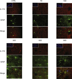 Effect of chronic exposure to low doses of ozone on IL-17A expression in microglia. Double-labelled fluorescence analysis of the hippocampus from rats exposed to low doses of ozone for 7, 15, 30, 60, and 90 days. Microglial cells are labelled in green and IL-17A in red. The main images show the dentate gyrus at 100× magnification; boxes show the same structure at 10× magnification. Blue arrows indicate marker colocalisation. Note that microglia in the dentate gyrus present higher immunoreactivity to IL-17A at 15 days of exposure. Scale bar=20microns.