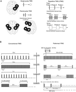 (A) Diagrams of the different types of TMS: single-pulse, paired-pulse in one or 2 different cortical areas, and repetitive TMS (low-frequency, ≤1Hz; high frequency, ≥5Hz). TMS: transcranial magnetic stimulation; rTMS: repetitive TMS; ®: response. Adapted from Pascual-Leone and Tormos-Muñoz.2 (B) Left: conventional rTMS (regularly repeated single pulses of TMS). From top to bottom: 10s of rTMS at 1Hz (first trace) and 5Hz (second trace); 1s of rTMS at 10Hz and a typical example of the therapeutic use of rTMS at 20Hz (2-second trains interleaved with 28-second intervals). Right: patterned rTMS (repeated application of short bursts of rTMS at a high inner frequency interleaved with short intervals of no stimulation). From top to bottom: 20s of continuous TBS (first trace); intermittent TBS (second trace); and intermediate TBS (third trace). The fourth trace shows quadri-pulse stimulation protocols. cTBS: continuous TBS; imTBS: intermediate TBS; ISI: interstimulus interval; iTBS: intermittent TBS; QPS: quadri-pulse stimulation; TBS: theta burst stimulation. Adapted from Rossi et al.5