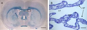 (A) Optical microscopy image (Klüver–Barrera staining) of a coronal slice from the brain of a rat, showing the choroid plexus within the lateral ventricles. B) Closer image of the choroid plexus (64×), with the same staining technique. Scale bar: (A) 1600μm; (B) 40μm. CE: choroid plexus epithelium; L: lumen; LV: lateral ventricle; ST: stroma.
