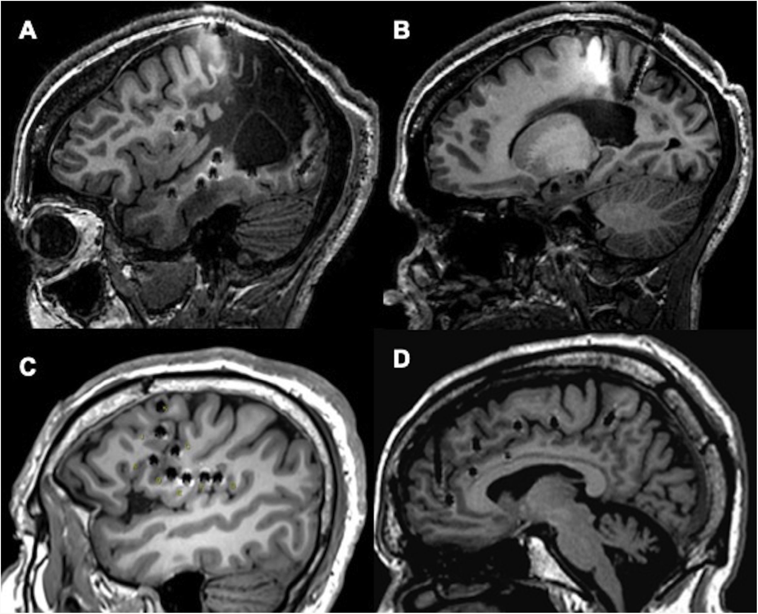 fig0015