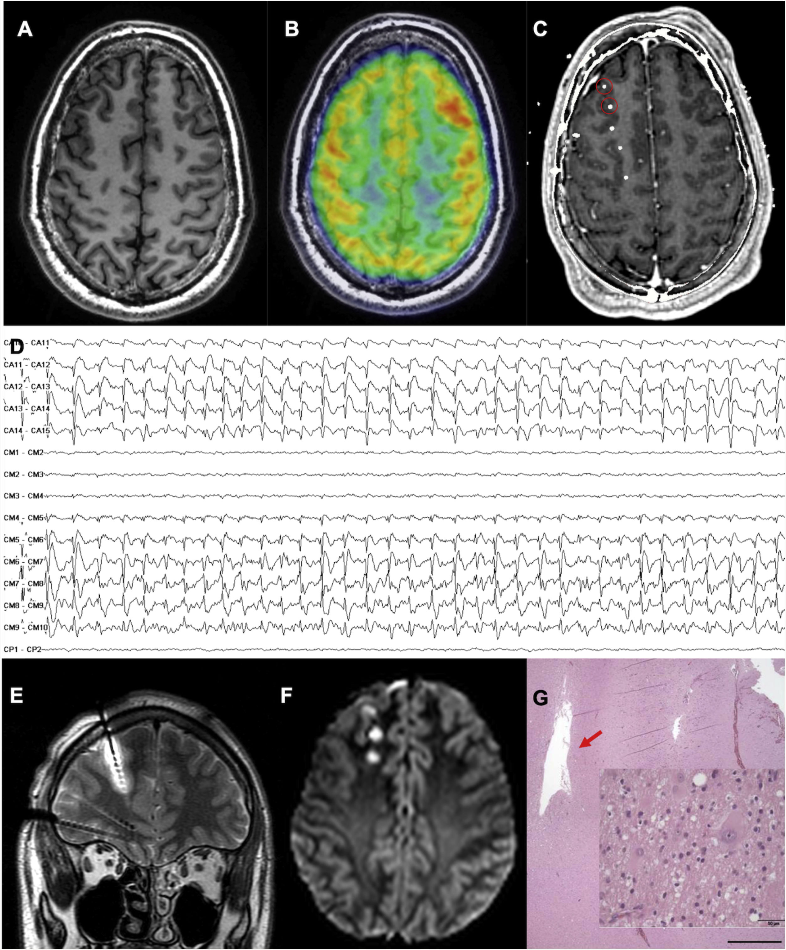 fig0025