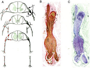 Minimally altered reproduction of figures 65 to 67 from Krücke