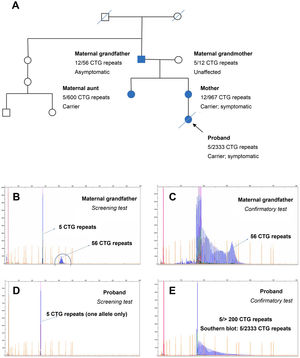 Study of a family including 2 patients with myotonic dystrophy type 1 (protomutation and full mutation, respectively). A) Pedigree chart. B,C) Electropherograms for the screening and confirmatory tests performed in the proband’s maternal grandfather. D,E) Electropherograms for the screening and confirmatory tests performed in the proband.