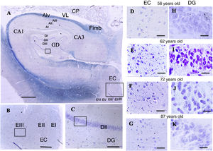 A: Cross-sectional slice of the hippocampus (dentate gyrus and cornu ammonis) and entorhinal cortex. Scale bar = 1000 µm. B: Detail of the EC in image A (scale bar = 250 µm); the small square shows the grid cells of lamina III. C: Detail of the DG in image A (scale bar = 250 µm); the small square shows the place cells of lamina III. D, E, F, G: Photomicrographs of EC lamina III, showing the possible location of grid cells. H, I, J, K: Photomicrographs of DG lamina III showing the possible location of the place cells (scale bar = 50 µm). AI: lamina I of the cornu ammonis; AII: lamina II of the cornu ammonis; AIII: lamina III of the cornu ammonis; Alv: alveus; CA1/CA3: subfields 1 and 3 of the cornu ammonis; CP: choroid plexi; DG: dentate gyrus; DI: lamina I of the DG; DII: lamina II of the DG; DIII: lamina III of the DG; EC: entorhinal cortex; EI: lamina I of the EC; EII: lamina II of the EC; EIII; lamina III of the EC; EV: lamina V of the EC; EVI: lamina VI of the EC; Fimb: fimbria; LV: lateral ventricle. Squares in the DG indicate the possible location of place cells; squares in the EC are the possible location of grid cells.