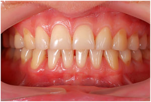 Example of a patient periodontally healthy.