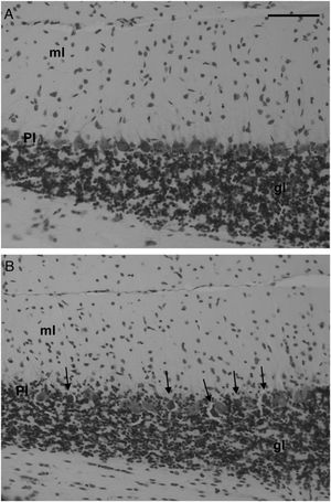 Representative photomicrographs of the cerebellar cortex stained with cresyl violet. The spherical cell bodies of the Purkinje cells in the Saline control rats (A) are regularly aligned in the Purkinje cell layer (Pl) between the granular (gl) and molecular (ml) layers. In the 3-AP-treated rats (B), the Purkinje cell somata were shrunken, hyperchromatic, and scattered (arrows) within the Purkinje cell layer. Scale bar=150μm.