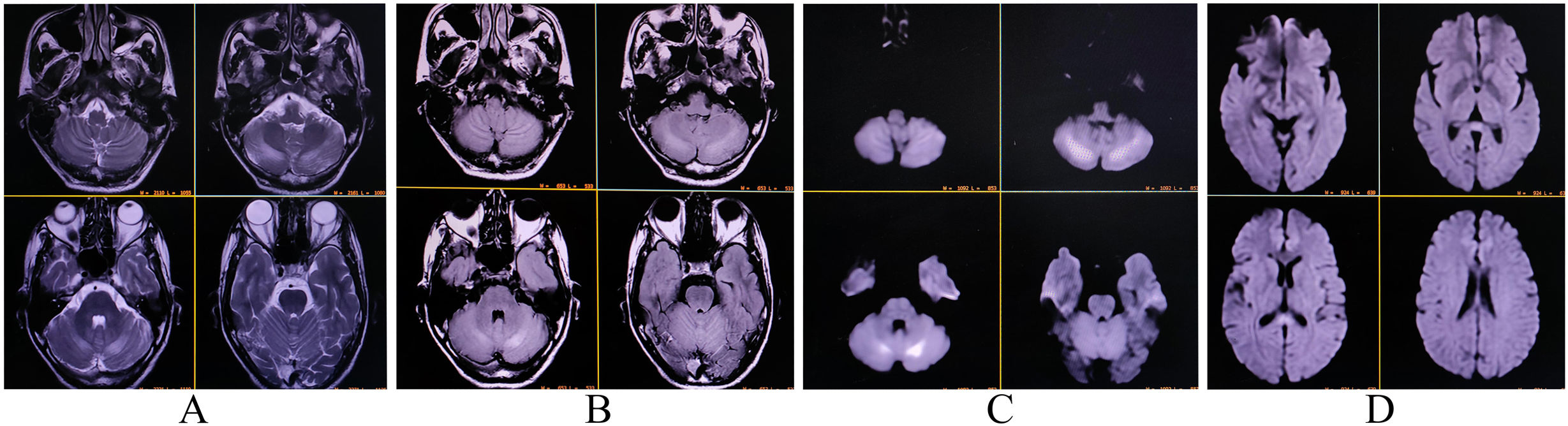fig0005