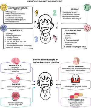 Pathophysiology and exacerbating factors of drooling.