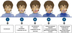 Sialorrhoea visual scale.