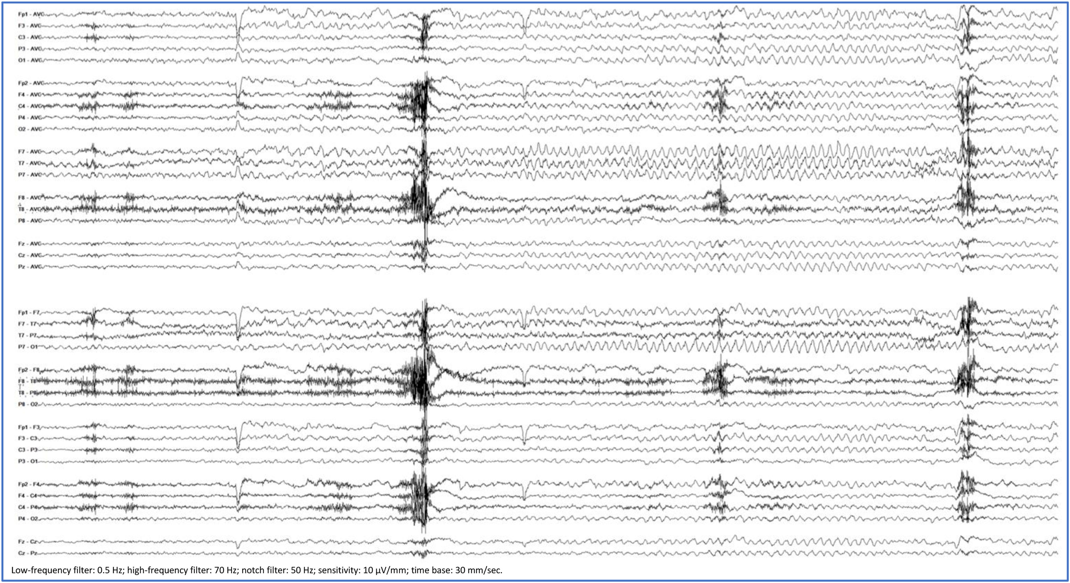 fig0005