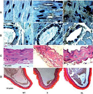 Photomicrographs of cross-sections of the left ventricle, showing the areas immunoreactive to CD40L in the myocardium and coronary artery (brown) (A and B); photomicrographs of sections of the aorta stained with hematoxylin/eosin (C) and picrosirius red (D). HL: hyperlipidemic; S: standard; WT: wild type.