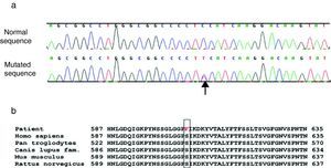 (a) Heterozygous c.1817 C>T p.S606F mutation (arrow) in the KCNH2 gene. The upper line is the sequence from a normal control. (b) Homology of amino acid sequences in different species as tested by the NCBI HomoloGene program (http://www.ncbi.nlm.nih.gov/homologene). Codon p.S606 is homologous in all these species.