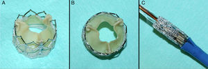 Edwards SAPIEN prosthetic valve. A and B: the unfurled prosthesis as it would appear following expansion over the native valve. C: the prosthesis mounted on the catheter and balloon prior to transfemoral introduction.