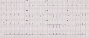 Electrocardiogram.