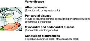 Radiotherapy-induced cardiotoxicity.