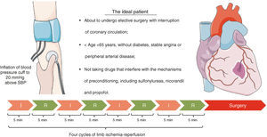 Proposed protocol for application of remote ischemic preconditioning. Figure produced using Servier Medical Art. I: ischemia; R: reperfusion; SBP: systolic blood pressure.