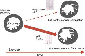 Scheme proposed for the significance of left ventricular trabeculation in athletes (adapted from 58). EF: ejection fraction; LV: left ventricular; LVED: left ventricular end-diastolic diameter; LVH: left ventricular hypertrophy.